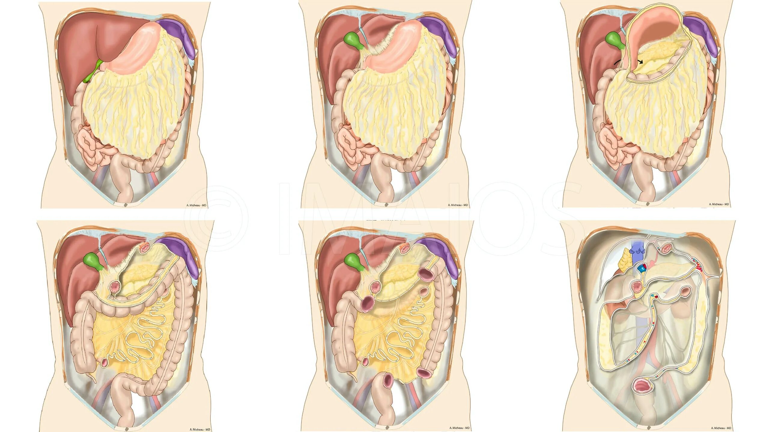 Абдоминальный модуль. Абдоминальный модуль. Пищеварительная система жкт человека. Брюшина - малый сальник, большой сальник. Сальник брюшной полости анатомия.