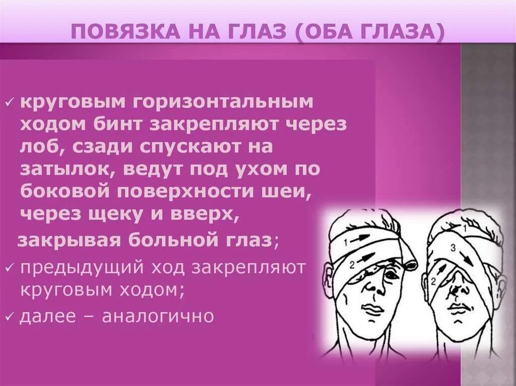 Наложение бинокулярной повязки алгоритм. Наложение повязки на оба глаза. Техника наложения монокулярной повязки. Десмургия монокулярная повязка. Наложение повязки на оба глаза.