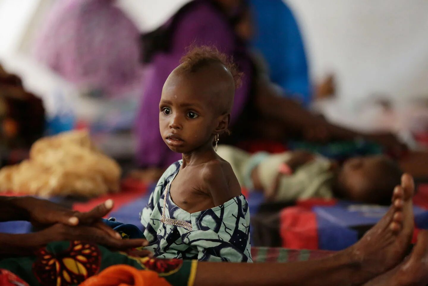 Starving people
