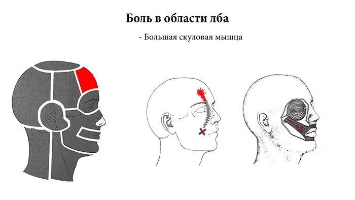 Давит голову области лба. Головные боли по зонам головы. Головная боль во лбу. Боль в области лба.