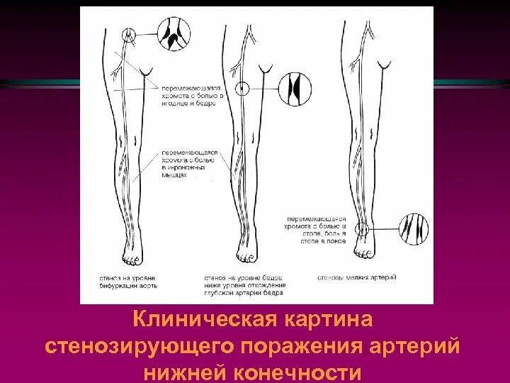 Пульсация артерий нижних конечностей схема. Измерение пульса на артериях нижних конечностей. Точки определения пульсации на артериях нижних конечностей. Точки пульсации артерий на нижних конечностях. Пульсация артерий стопы