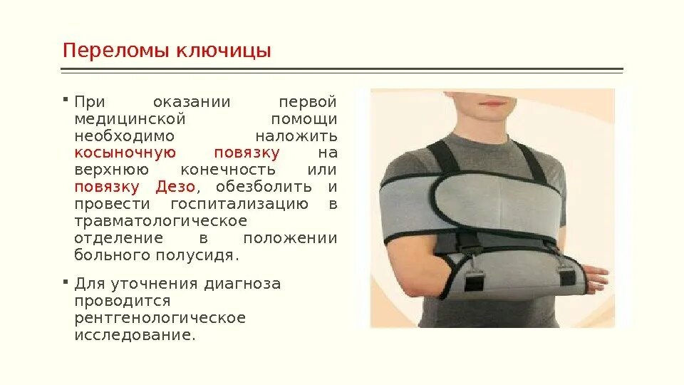 При переломе ключицы оказывают первую помощь. Повязка дезо при переломе ключицы у ребенка 3 года. дезо для детей при переломе ключицы. оказание 1 помощи при переломе ключицы.