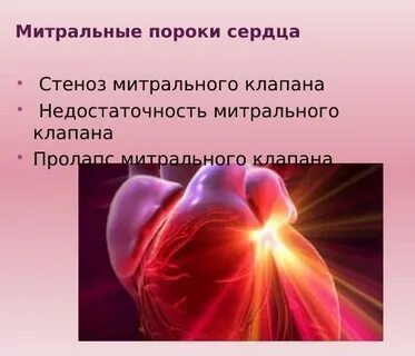 Какой диагноз сердца
