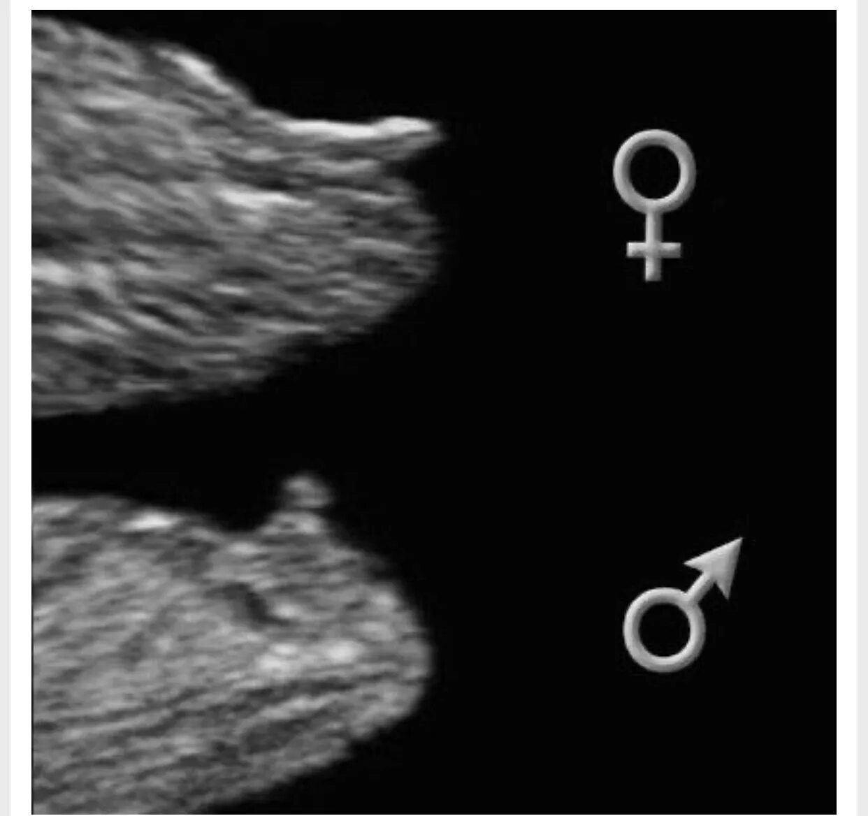Фото УЗИ ребёнка на 12 недели беременности и пол ребенка. Как по УЗИ определяют пол ребенка в 12 недель. УЗИ В 12 недель беременности пол ребенка мальчика. Пол плода на УЗИ В 12 недель беременности. Как отличить на узи