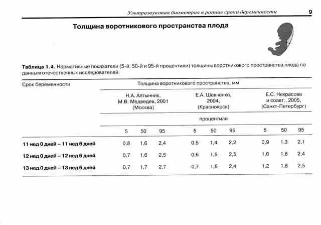 Толщина воротникового пространства 1 1. Толщина воротникового пространства 1 скрининг норма. воротниковое пространство в 12 недель норма таблица. толщина воротникового пространства в 12 недель норма. твп на 12 неделе беременности норма таблица.