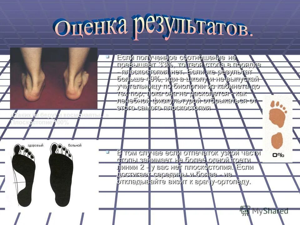 К какому врачу идти с плоскостопием. Плоскостопие презентация. Плоскостопие 2 степени у ребенка. Плоскостопие презентация. Степени плоскостопия.