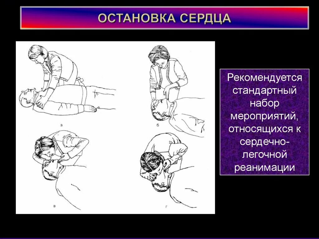 Хамиль остановка сердца. Сознательная остановка сердца. Неожиданная остановка сердца. Временная остановка сердца.