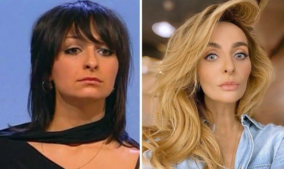 Logyka СТАЛО ИЗВЕСТНО СКОЛЬКО ПЛАСТИЧЕСКИХ ОПЕРАЦИЙ СДЕЛАЛА КАТЯ ВАРНАВА