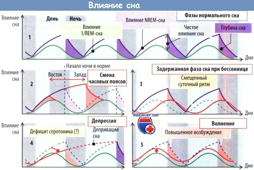 Rem фаза сна. Нормальный график фаз сна. Нарушение фазы быстрого сна. Фазы сна Rem сон. Расширенная фаза