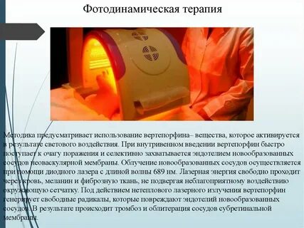 Фотодинамическая терапия отзывы