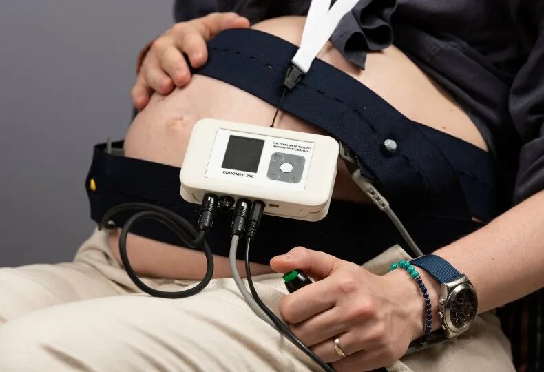 Показатели маточных артерий при беременности. Доплер чсс. Доплер артерия пуповины норма. Кровоток в маточных артериях норма при беременности. Скорость в средней мозговой артерии плода норма.