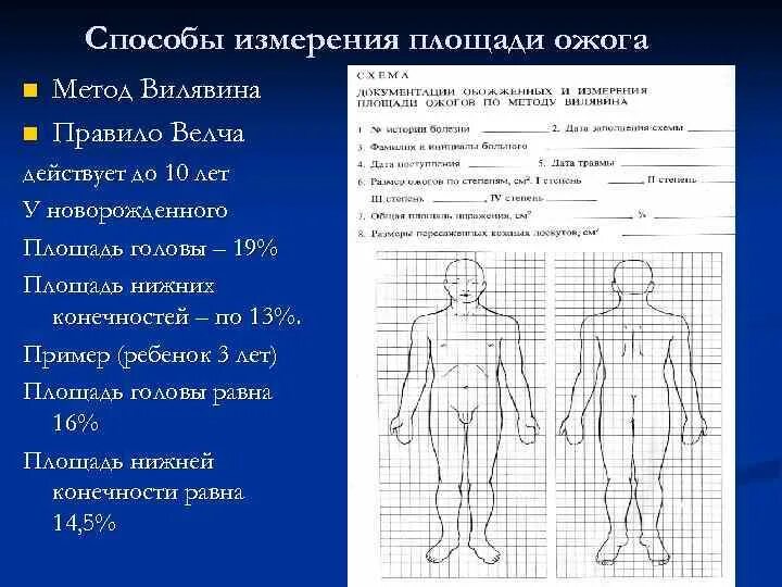 Методы определения площади ожогов. Методы определения площади ожогов