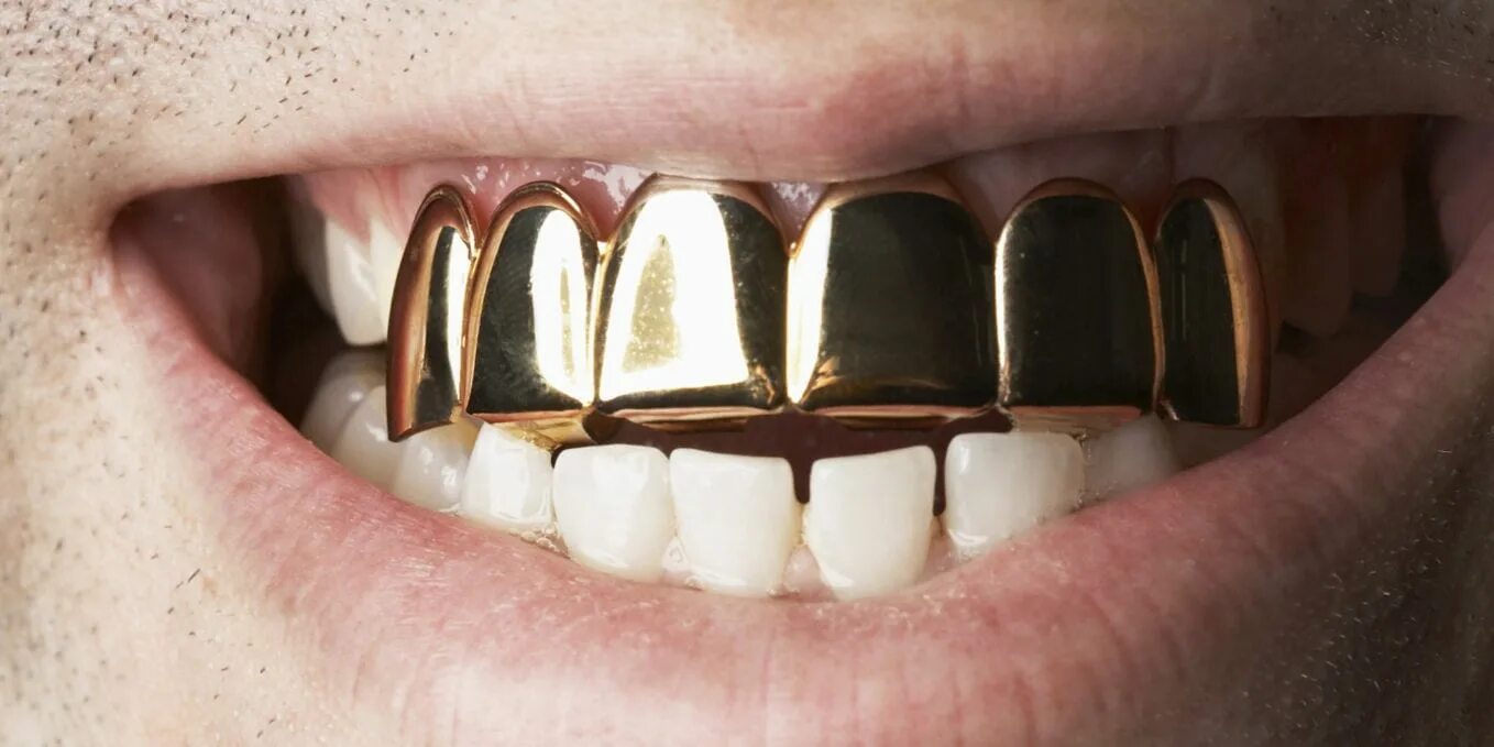 Сколько стоит металлические зубы. Серебряные грилзы на клыки. Платиновые грилзы. Металлическая коронка. Металлическая коронка на зуб.