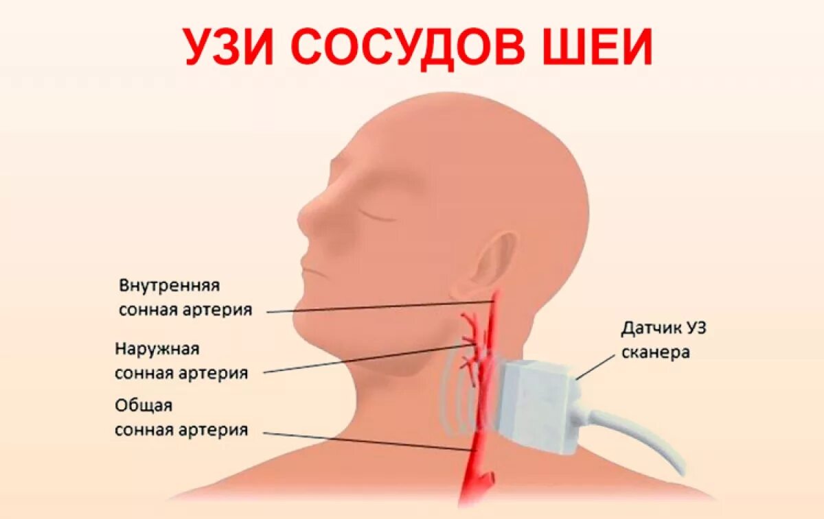 Как называется узи шеи и головы. Узи сосудов шеи. узи брахиоцефальных аретри.