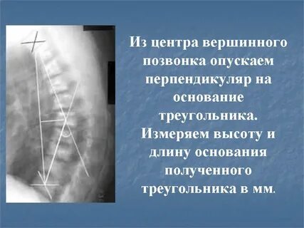 Болезнь шейермана по утвержденным