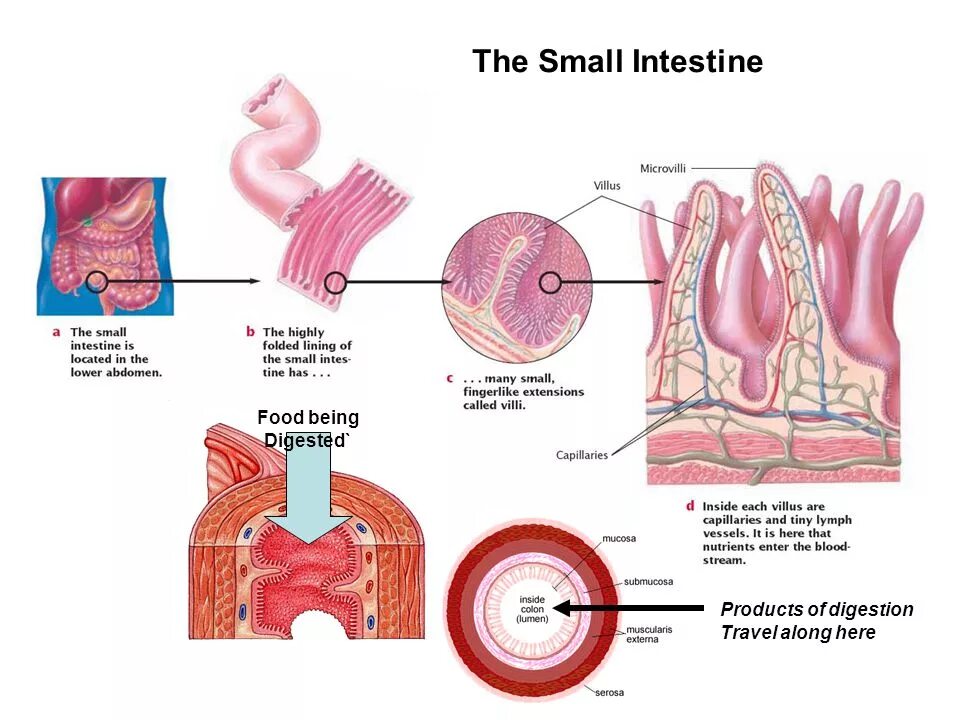 The small intestine. Ileitis  infectious  neoplasms of the small intestine  spondyloarthropathy  medicinal  vascular  infiltrative.