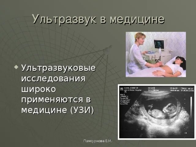 Ультразвук как проходит. Ультразвук как проходит