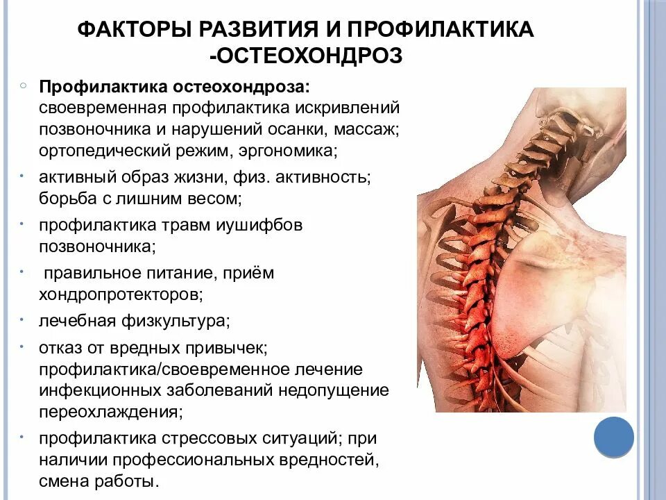 Локальный статус позвоночник. Остеохондроз. Профилактика остеохондроза. Памятка остеохондроз. Шейный отдел позвоночника профилактика.