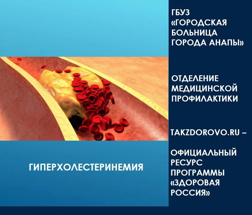 Гиперхолестеринемия что это такое и как лечить. Гиперхолестеринемия. профилактика гиперхолестеринемии. семейная гиперхолестеринемия. первичная гиперхолестеринемия.