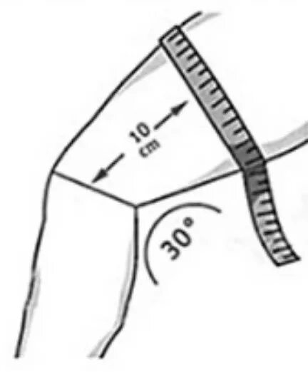Как измерить колено. Наколенник компрессионный ottobock knee sleeve 2041. Обхват колена как измерить для наколенников. Измерение колена для бандажа. Ортез коленный ottobock genu direxa 8353-7.