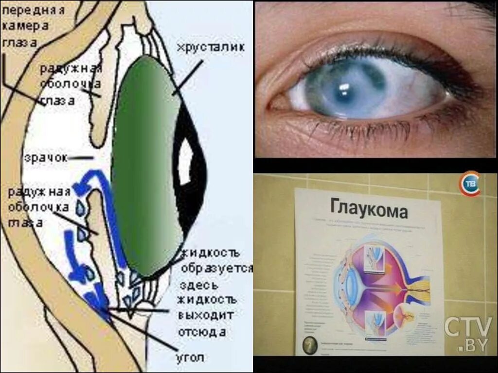 Передняя камера глаза. Передняя и задняя камеры глаза. Передняя камера глаза где. Задняя камера глаза.