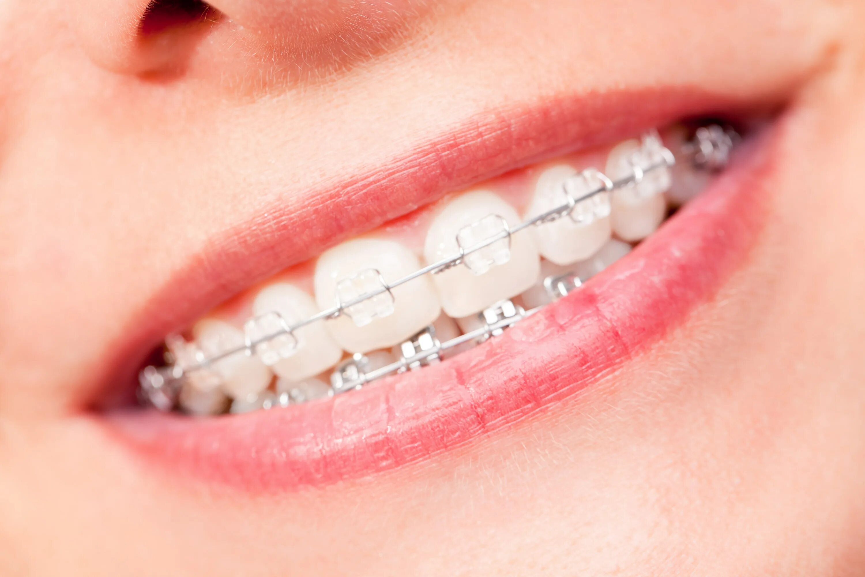 Matching brackets