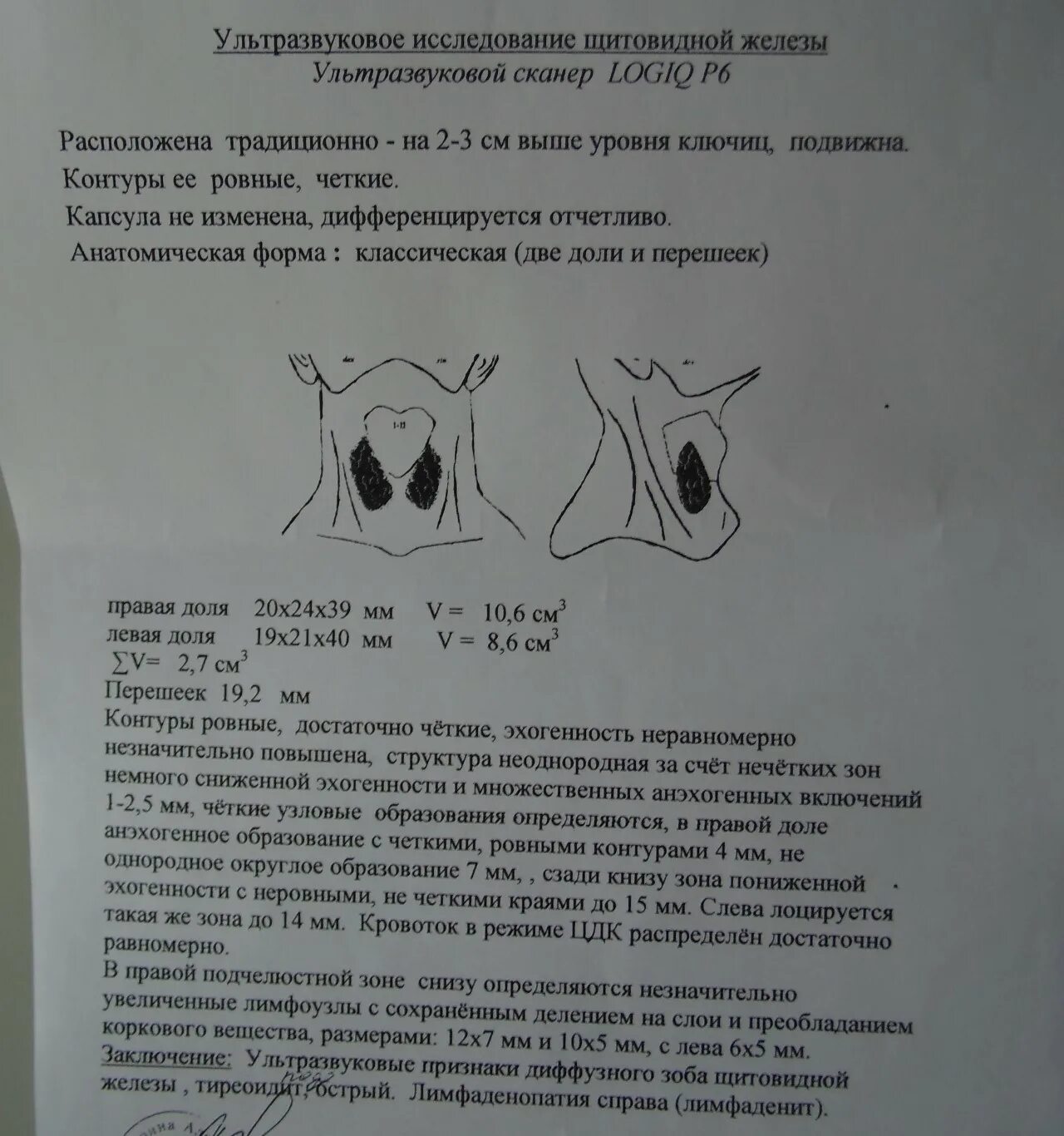 Узел в правой доле щитовидной железы. Протокол УЗИ щитовидной железы. УЗИ щитовидной железы заключение. Объем щитовидной железы УЗИ нормы. УЗИ щитовидной железы описание.