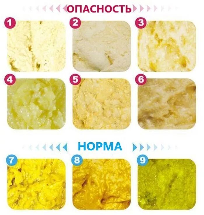 Кал месячного ребенка норма. Светло жёлтый кал у грудничка. нормальный цвет кала у грудничка. светло желтый стул у грудничка. светло желтый кал у ребенка грудничка.