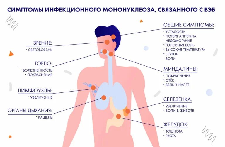 Ковид без температуры симптомы у взрослых 2024. Инфекция Эпштейна-Барр симптомы. Вирус Эпштейн бара симптомы. Вирус Эпштейна-Барр 4 типа симптомы. Вирус герпеса 4 типа Эпштейн Барра.