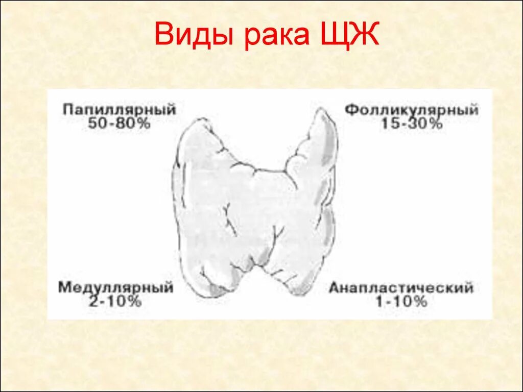 Опухоль щитовидной железы. Формы опухолей щитовидной железы. Злокачественная опухоль щитовидной железы. Фора опухолей щитовидной.