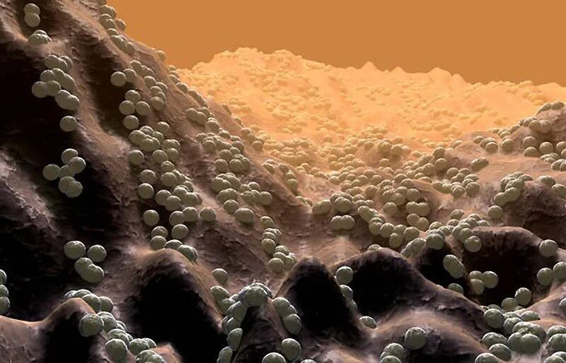 Микроб грязи