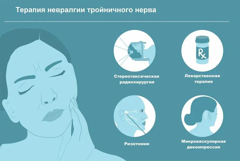 Невралгия тройничного нерва причины симптомы. Невралгия тройничного нерва синдромы. терапия невралгии тройничного нерва. невралгия тройничного нерва клинические проявления. невралгия тройничного нерва (тригеминальная невралгия.