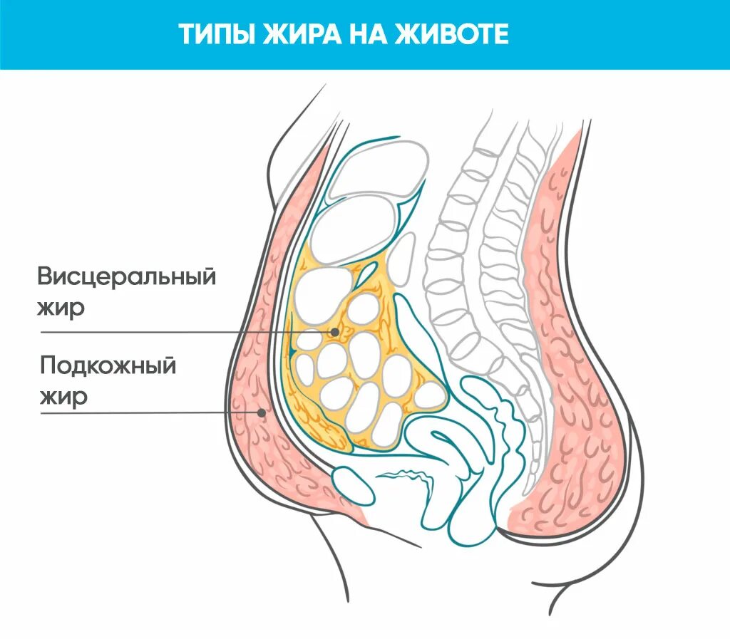 Подкожный жир и висцеральный жир. Подкожный, висцеральный жир на животе. Висцеральный жир в брюшной полости.