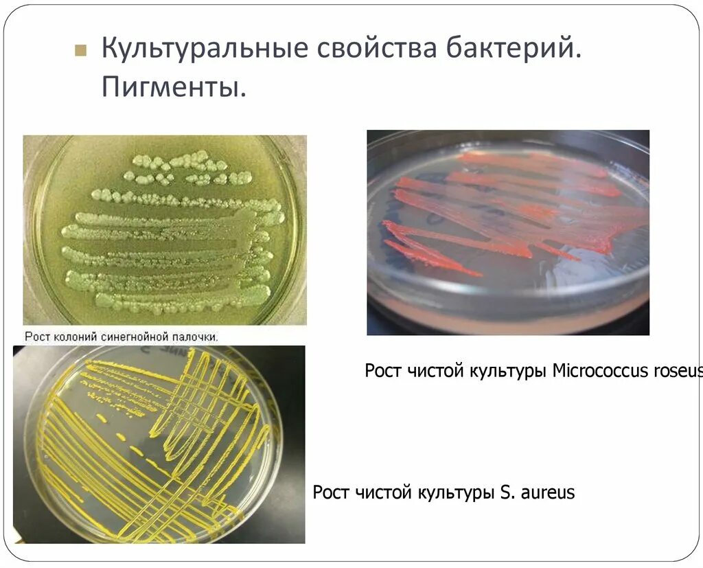 Культуральные признаки микробиология. Культуральные свойства бактерий пигменты бактерий. Культуральные свойства чистых культур микроорганизмов. Микробиологический метод культуральные свойства.