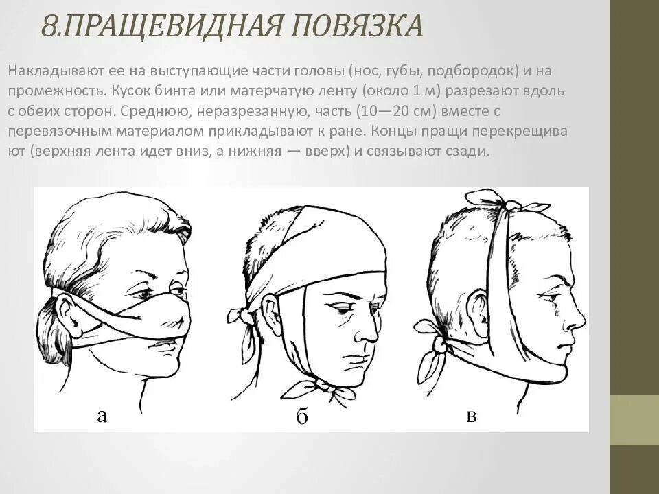 Пращевидная связка. Подбородочная пращевидная повязка. Десмургия пращевидная повязка. Схема наложения пращевидной повязки. Пращевидная повязка на нос и подбородок.