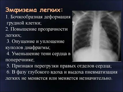 Эмфизема проявления