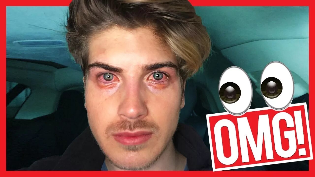 Go blind. Going blind.