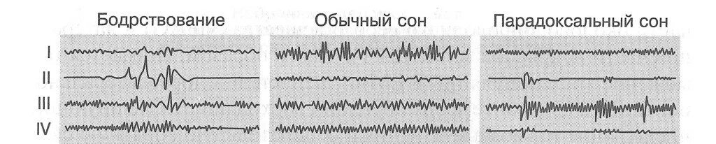 Фазы ээг. Ээг сна и бодрствования. стадия бодрствования и парадоксальный сон на ээг. фазы сна ээг. электроэнцефалограф для фаз сна.
