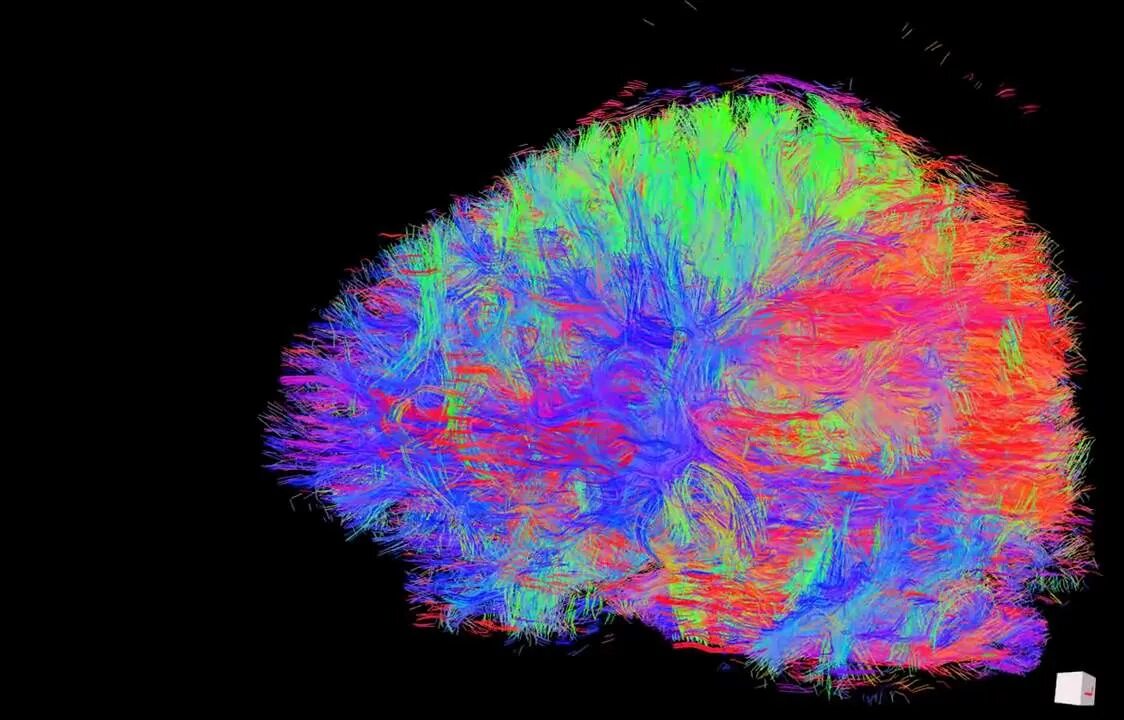 Diffusion tensor. Diffusion tensor imaging (dti). diffusion tensor imaging. dti brain. cortex hair.