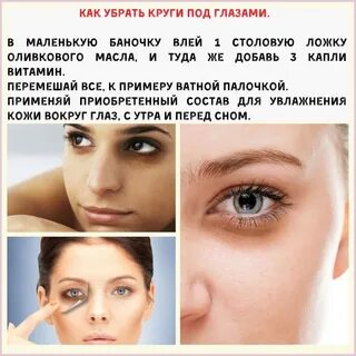 Черные круги вокруг глаз причина