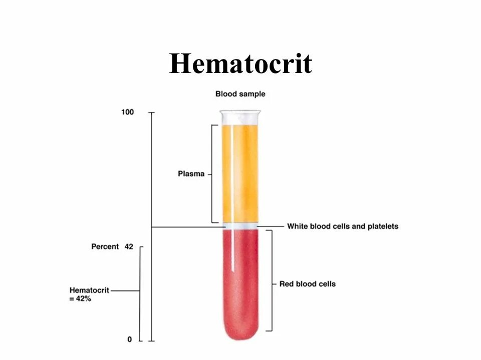 Hct понижен. Соотношение плазмы и форменных элементов крови (гематокрит). Гематокрит при анемии показатели. Как определить гематокритную величину крови. Гематокрит норма и патология.
