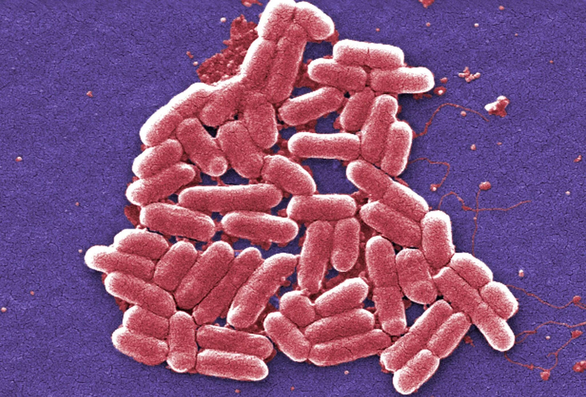 Staphylococcus e coli. Staphylococcus e coli