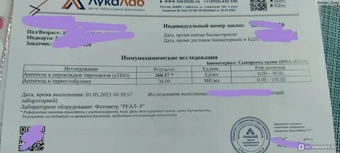 Какие анализы при выпадении волос у женщин