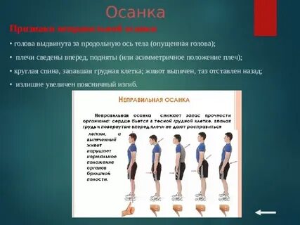 К каким нарушениям приводит неправильная осанка