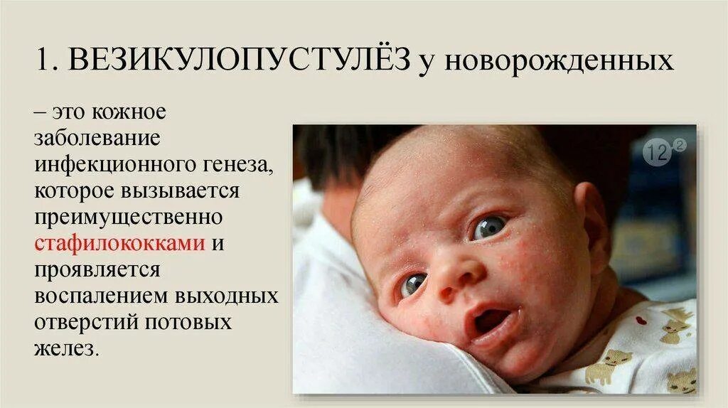 Золотистый стафилококк у грудничка