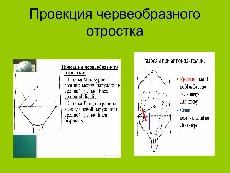 Точка простаты. Точка Ланца и Мак Бурнея. Точка Мак Бурнея и Ланца при аппендиците. Проекционные точки основания червеобразного отростка. Проекция червеобразного отростка на переднюю брюшную стенку.