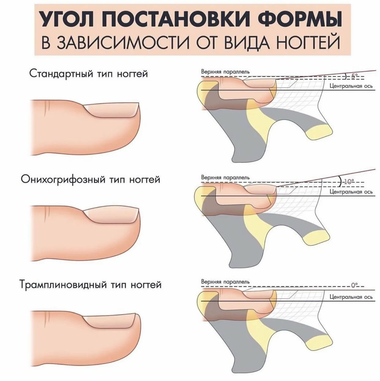 Правильная форма члена. Форма ногтей вид сбоку. Наращивание ногтей на формы схема. Схема опила формы наращивание ногтей. Постановка формы для наращ.