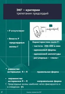 Критерии экг