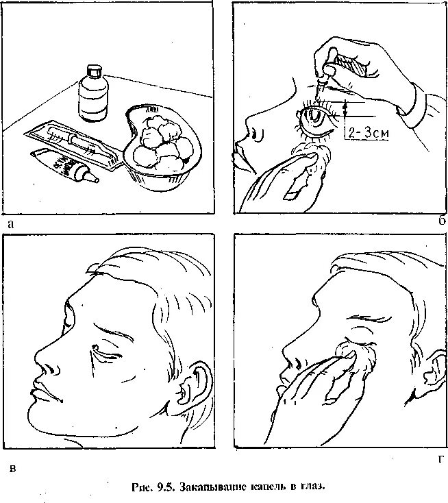 Закапывание капель детям алгоритм. Закапывание глазных капель алгоритм. Закапывание капель в глаза детям алгоритм. Алгоритм закапывания капель в глаза, нос.. Алгоритм закапывания капли в глаза.