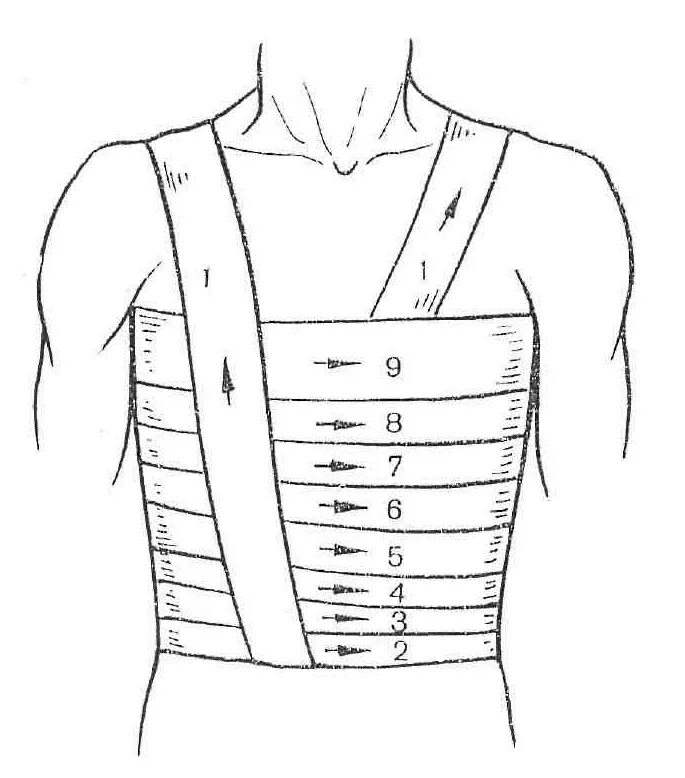 Спиральная повязка алгоритм. Техника наложения спиральной повязки на грудную клетку. Спиралевидная повязка на грудную клетку показания. Техника наложения спиралевидной повязки. Спиралевидная повязка на грудную клетку алгоритм.